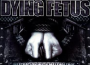 Infatuation With Malevolence ()專輯_Dying FetusInfatuation With Malevolence ()最新專輯