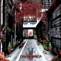 Cerebral Engorgement圖片照片_Cerebral Engorgement
